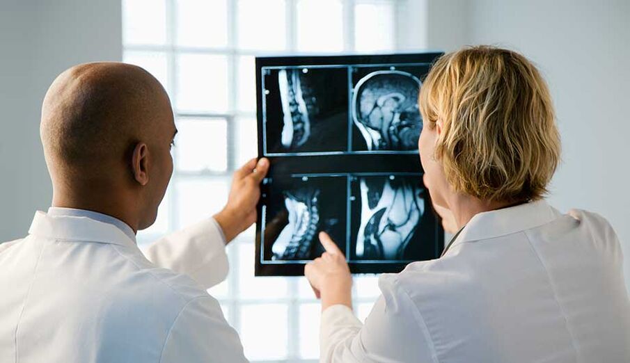 Diagnos vun cervikal Osteochondrose duerch Biller