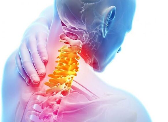 Osteochondrosis vun der Gebärmutterkierper
