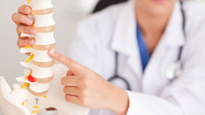 Erklärung vun der Lendeger Osteochondrose op engem Modell vun der Wirbelsäule